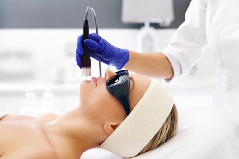 laser resurfacing