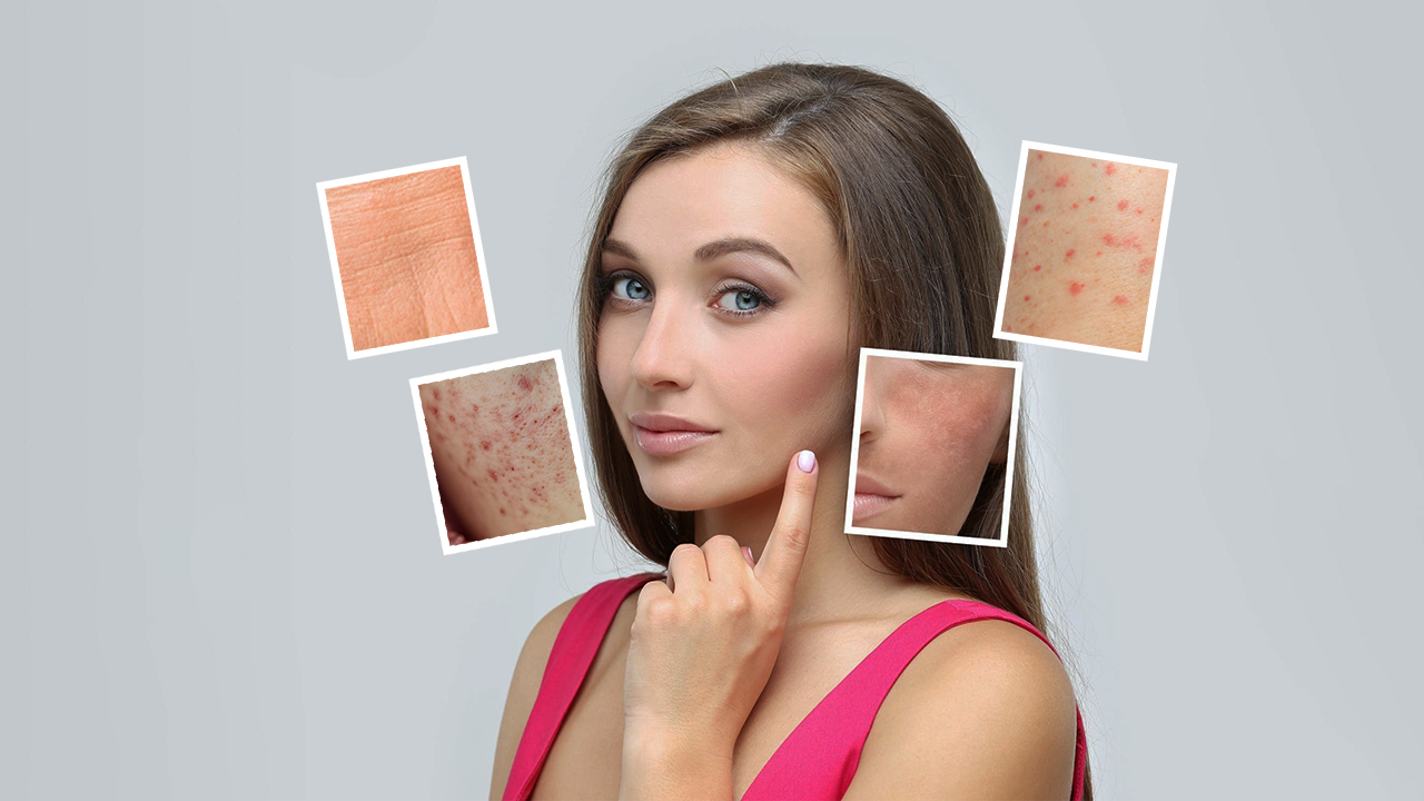 Dermatology Services in agra